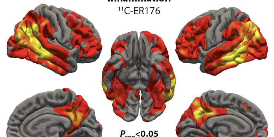 Imaging Neuroinflammation in Neurodegeneration